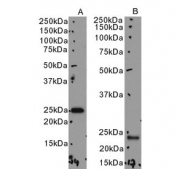Western blot testing of human A) K562 and B) ThP-1 cell lysate with UBE2T antibody. Predicted molecular weight: ~22 kDa.
