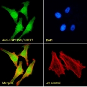 Immunofluorescent staining of fixed and permeabilized human HeLa cells with UBE2T antibody (green) at 10ug/ml, DAPI nuclear stain (blue) and Phalloidin (red).