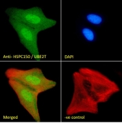 Immunofluorescent staining of fixed and permeabilized human U-2 OS cells with UBE2T antibody (green) at 10ug/ml, DAPI nuclear stain (blue) and Phalloidin (red).