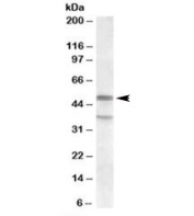 Western blot testing of KELLY lysate with HTR7 antibody at 1ug/ml. The expected ~50kDa band and the additional ~37kDa band are both blocked by the immunizing peptide.