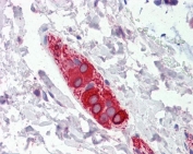 IHC testing of FFPE human colon tissue with FEZ1 antibody at 5ug/ml. Required HIER: steamed antigen retrieval with pH6 citrate buffer; AP-staining.
