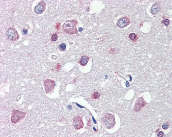 IHC testing of FFPE human brain (cortex) with FEZ1 antibody at 5ug/ml. Required HIER: steamed antigen retrieval with pH6 citrate buffer; AP-staining.