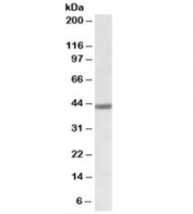 Western blot testing of human bone marrow lysate with FANCL antibody at 1ug/ml. Predicted molecular weight: ~43kDa.