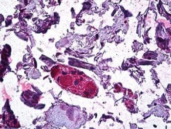 IHC testing of FFPE human colon tissue with DGAT1 antibody at 3.75ug/ml. HIER: steamed antigen retrieval with pH6 citrate