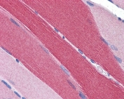 IHC testing of FFPE human skeletal muscle tissue with PDE4D antibody at 5ug/ml. Required HIER: steamed antigen retrieval with pH6 citrate buffer; AP-staining.