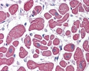 IHC testing of FFPE human heart tissue with PDE4D antibody at 5ug/ml. Required HIER: steamed antigen retrieval with pH6 citrate buffer; AP-staining.