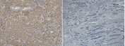 IHC staining of FFPE human kidney tissue with (left) and without (right) VPS25 antibody at 6ug/ml. Required HIER: steamed antigen retrieval with pH6 citrate buffer.