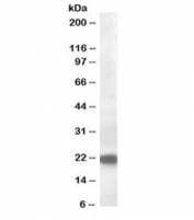 Western blot testing of rat kidney lysate with VPS25 antibody at 0.5ug/ml. Predicted molecular weight: ~21 kDa.