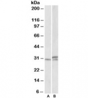 Western blot testing of mouse and rat spinal cord lysates with HOXA9 antibody at 1ug/ml. Predicted molecular weight ~30kDa.