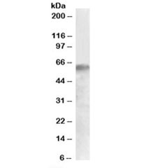 Western blot testing of human liver lysate with IRF2BP1 antibody at 0.5ug/ml. Predicted molecular weight: ~62kDa but can be observed at up to 75kDa.~