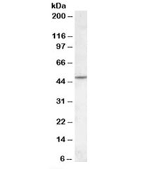 Western blot testing of human cerebellum lysate with CHRNB2 antibody at 1ug/ml. Predicted molecular weight: ~57kDa but can be observed at ~50kDa.~