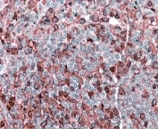 IHC staining of FFPE human spleen with NFATC2 antibody at 4ug/ml. HIER: steamed with pH6 citrate buffer, AP-staining.