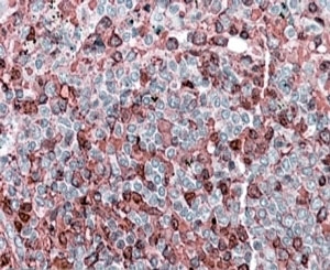 IHC staining of FFPE human spleen with NFATC2 antibody at 4ug/ml. HIER: steamed with pH6 citrate buffer, AP-staining.