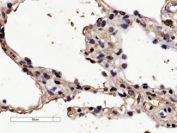 IHC testing of FFPE human lung tissue with Histamine receptor H1 antibody. HIER: steamed with pH6 citrate buffer, HRP-staining. Membranous staining of epitheilial cells in tertiary bronchus and in alveoli is seen.