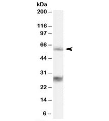Western blot testing of 293 lysate with MPP6 antibody at 0.3ug/ml. The expected ~60kDa band and the additional ~28kDa band are both blocked by the immunizing peptide.