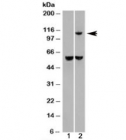 Western blot of HEK293 lysate overexpressing IDE probed with IDE antibody (mock transfection in lane 1). Predicted molecular weight: ~118kDa.