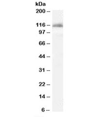 Western blot testing of K562 cell lysate with IDE antibody at 0.1ug/ml. Predicted molecular weight: ~118kDa.