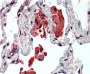 IHC staining of FFPE human lung with IDE antibody at 2.5ug/ml. HIER: steamed with pH6 citrate buffer, AP-staining.