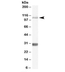 Western blot testing of mouse brain lysate with Insulin degrading enzyme antibody at 1ug/ml. The expected ~118kDa band and the additional ~30kDa band are both blocked by immunizing peptide.