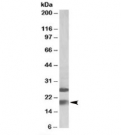 Western blot testing of human frontal cortex lysate with MPV17 antibody at 2ug/ml. The expected ~19kDa band and additional ~26kDa band are both blocked by immunizing peptide.
