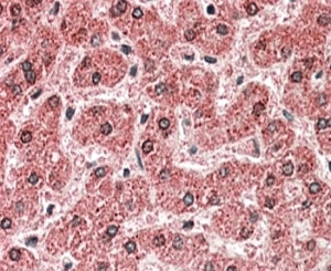 IHC staining of FFPE human liver with MPV17 antibody at 5ug/ml. HIER: steamed with pH6 citrate buffer, AP-staining.~