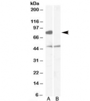 Western blot testing of human brain [frontal cortex] lysate with [B] and without [A] immunizing peptide using ZDHHC8 antibody at 0.1ug/ml. Predicted/observed molecular weight: ~81kDa.