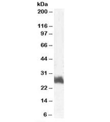 Western blot testing of human bone marrow lysate with FRA1 antibody at 1ug/ml. Predicted molecular weight: ~29kDa.