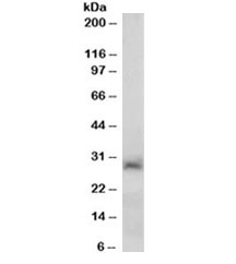 Western blot testing of human liver lysate with SIRT3 antibody at 0.2ug/ml. Predicted molecular weight: 44/28 kDa (full/processed).