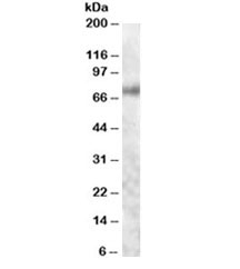 Western blot testing of human colon lysate with Myb antibody at 1ug/ml. Predicted molecular weight 60~85 kDa (isoform