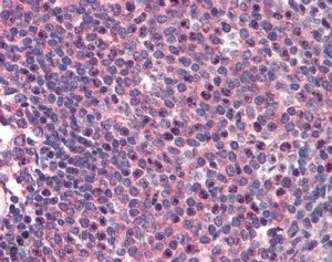 IHC staining of FFPE human spleen with CARD11 antibody at 2ug/