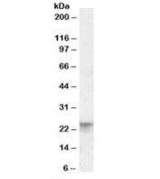 Western blot testing of human colon lysate with TSPAN8 antibody at 0.01ug/ml. Predicted molecular weight: ~26kDa.