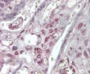 IHC staining of FFPE human placenta with XLF antibody at 4ug/ml. HIER: steamed with pH6 citrate buffer, AP-staining.