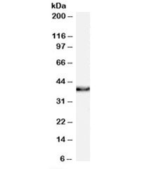 Western blot testing of human thyroid lysate with XLF antibody at 0.1ug/ml. Predicted molecular weight: ~33kDa, routinely observed at ~37kDa. (Ref 1)~