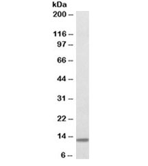 Western blot testing of human duodenum lysate with beta-2-microglobulin antibody at 0.3ug/ml. Predicted molecular weight ~14kDa.