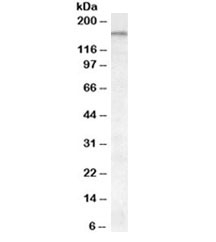 Western blot testing of cerebellum lysate with ABCA9 antibody at 0.1ug/ml. Predicted molecular weight: ~184kDa.~