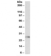 Western blot testing of human bone marrow lysate with HLA-DQA2 antibody at 0.3ug/ml. Predicted molecular weight: ~28kDa.