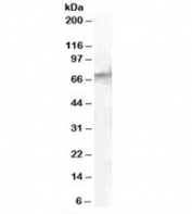 Western blot testing of human spleen lysate with STAM2 antibody at 1ug/ml. Predicted molecular weight: ~58kDa, routinely observed at ~70kDa. (Ref 1)