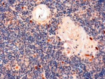 IHC staining of FFPE human thymus with AIRE antibody at 2ug/ml. HIER: steamed with pH9 Tris/EDTA buffer, HRP-staining.