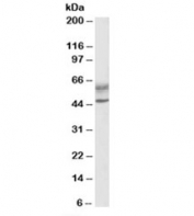 Western blot testing of human lymph node lysate with AIRE antibody at 0.5ug/ml. Predicted molecular weight: ~58/37kDa (isoforms 1/2). Both observed bands are both blocked by the immunizing peptide.
