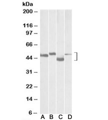 Western blot testing of mouse brain (lane A), rat brain (lane B), mouse thymus (lane C) and rat thymus (lane D) lysates with MEIS2 antibody at 0.1ug/ml. Predicted molecular weight: ~52/44/42kDa (isoforms c/a/g-human and 4/3/5-mouse).