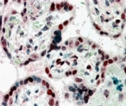 IHC staining of FFPE human placenta with CBX1 antibody at 2.5ug/ml. HIER: steamed with pH6 citrate buffer, AP-staining.