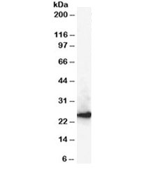 Western blot testing of A431 lysate with CBX1 antibody at 0.3ug/ml. Predicted molecular weight ~25kDa.~