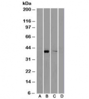 Western blot of HEK293 lysate overexpressing AKR1B10-FLAG tag probed with B) anti-FLAG in the left panel and with C) AKR1B10 antibody in the right panel (corresponding mock transfection in lanes A and D). Predicted molecular weight: ~36kDa.