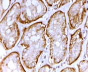 IHC testing testing of FFPE human kidney with SAT1 antibody at 2ug/ml. HIER: steamed with pH6 citrate buffer, HRP-staining.