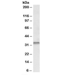 Western blot testing of human colon lysate with Caspase 6 antibody at 0.3ug/ml. Predicted molecular weight: ~33kDa (precursor).