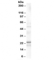 Western blot testing of K562 cell lysate with TIRAP antibody at 0.1ug/ml. Predicted molecular weight: ~24/25kDa (isoforms a/b).