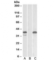 Western blot testing of HEK293 lysate overexpressing human PIM2-MYC with PIM2 antibody (0.1ug/ml) in Lane A and anti-MYC (1/1000) in lane C. Mock-transfected HEK293 probed with PIM2 (0.1ug/ml) in Lane B. Predicted molecular weight: ~34kDa.