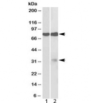Western blot testing of 1) fetal mouse brain and 2) rat brain lysate with GPM6A antibody at 2ug/ml. Predicted molecular weight: ~32/80kDa (unmodified/glycosylated).