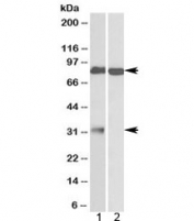 Western blot testing of human 1) cerebellum and 2) olfactory bulb lysate with GPM6A antibody at 1ug/ml. Predicted molecular weight: ~32/80kDa (unmodified/glycosylated).