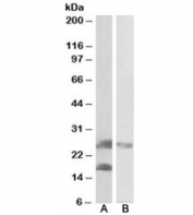 Western blot of mouse (A) and rat (B) skeletal muscle lysates with Dynactin 3 antibody at 0.2ug/ml. Expected molecular weight (mouse): ~24kDa.